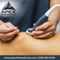 Dry Needling In Hampton Cove | Apex Chiropractic & Functional Wellness