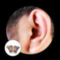 Hearing Aid Fitting In Noida