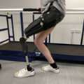 Trusted Prosthetic Leg, Hand & Arm Specialists In Malaysia
