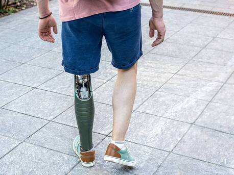 Kuala Lumpur, Businesses For Sale, Trusted Prosthetic Leg, Hand & Arm Specialists In Malaysia