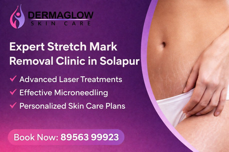 Mumbai, Medical, Professional Stretch Mark Treatment In Solapur | Expert Skin Specialists
