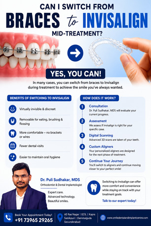 Hyderabad, Dental, Unhappy With Metal Braces? Switch To Invisalign At Smile Dental &ndash; ECIL