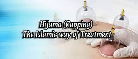 Riyadh, Guides/Interpreters, Hijama (Cupping Therapy) The Best Treatment For Cleansing Your Body & Soul.