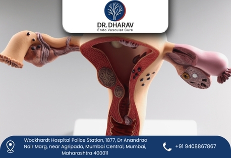 Mumbai, Health, Dr. Kheradia &ndash; Expert UFE Specialist In Mumbai