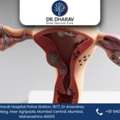 Dr. Kheradia &ndash; Expert UFE Specialist In Mumbai