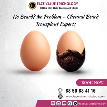 Chennai, Legal, Beard Transplant In Chennai  Get A Thick & Stylish Beard Naturally