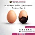Beard Transplant In Chennai  Get A Thick & Stylish Beard Naturally