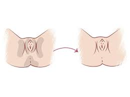Faridabad, Dental, Natural Treatment For Sexual Problems Clinic In Faridabad