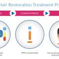 Platelet Rich Plasma Treatment In Ahmedabad For Natural Hair Regrowth