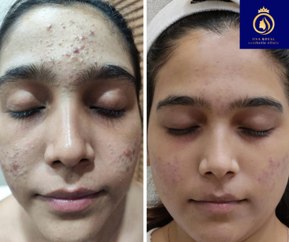 Thane, Fashion & Design, Professional Anti Ageing Skin Care Services In Thane | DNA Royal.