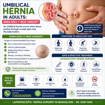 Mumbai, Health, Umbilical Hernia In Adults: When Does It Need Surgery?