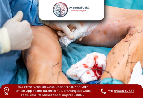 Ahmedabad, Health, Improve Circulation With Advanced Medical Care