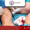 Improve Circulation With Advanced Medical Care