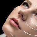 Best Hair Transplant Doctor In Delhi For Natural And Long Lasting Results
