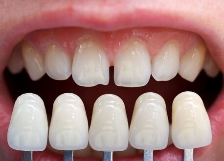 Ahmedabad, Health, Best Dental Clinic In Vasna