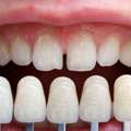 Best Dental Clinic In Vasna