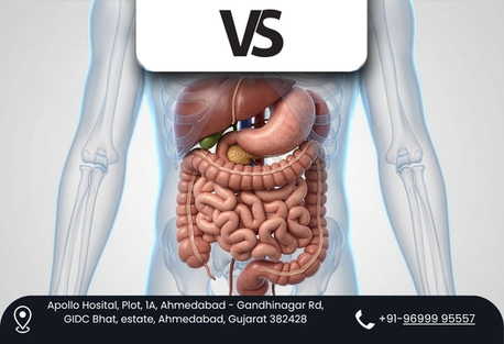 Ahmedabad, Health, Restoring Digestive Health Through Advanced Gastrointestinal Care