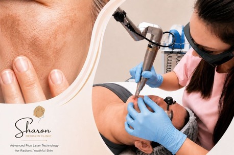 Sydney, Beautician, Pico Laser For Melasma & Asian Skin Treatment In Sydney