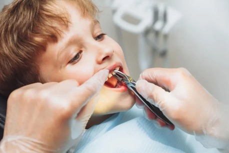 The Hague, Dental, Wat Zijn De Voordelen Van Regelmatige Mondzorg In Almere?