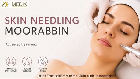 Melbourne, Health & Beauty Items, Best Skin Needling Moorabbin  | Skin Treatments & Care