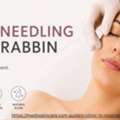 Best Skin Needling Moorabbin | Skin Treatments & Care