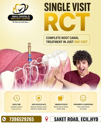 Hyderabad, Dental, Complete Root Canal In Just ONE Visit &ndash; Smile Dental, ECIL
