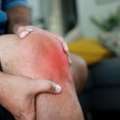 Swollen Knee? Find Out The Causes, Treatment & When To Worry | Knee Specialist Manchester