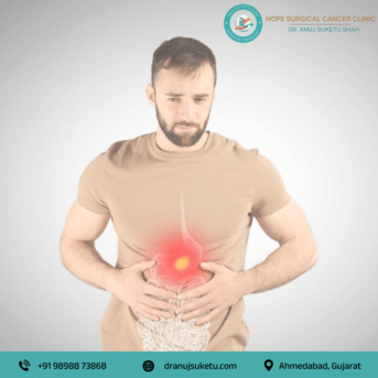 Ahmedabad, Health, Stomach Cancer Treatment In Ahmedabad - Dr. Anuj Suketu Shah