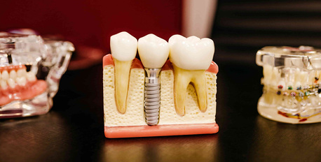 Gurgaon, Dental, Top Dentist In Gurgaon - Dr. Manoti Sehgal