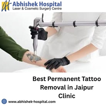 Jaipur, Health, Best Permanent Tattoo Removal In Jaipur Clinic