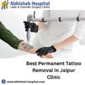 Best Permanent Tattoo Removal In Jaipur Clinic