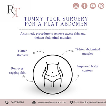 Mumbai, Health, Tummy Tuck Surgery In Mumbai For Post-Pregnancy Body