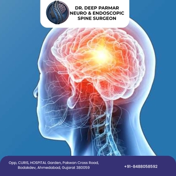 Ahmedabad, Health, Expert Care For Brain Hemorrhage Treatment In Ahmedabad &ndash; Dr Deep Parmar