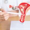 IVF & Fertility Specialists In Chennai &ndash; Expert Care