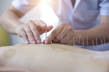 Sydney, Health, Acupuncturist In Adelaide | Natural Pain Relief & Wellness Care