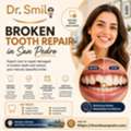 Broken Tooth Repair In San Pedro Restore Your Confident Smile