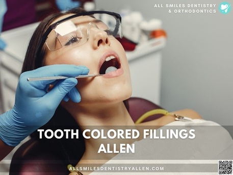 Dallas, Dental, Dental Fillings Allen TX | Natural Tooth-Colored Cavity Fillings
