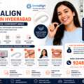 Invisalign Treatment In Hyderabad