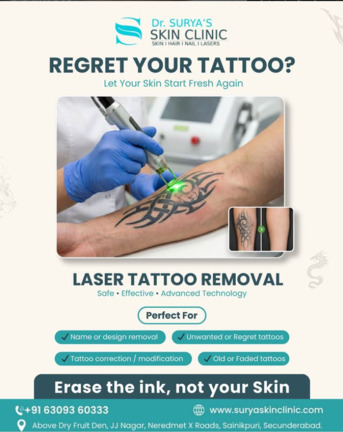 Mumbai, Health, Advanced Laser Care For Healthy, Clear Skin