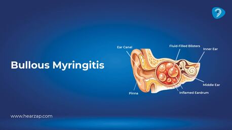 Hyderabad, Health & Beauty Items, INR 30000,  Myringotomy: Procedure, Benefits, Recovery & Cost Guide