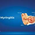 INR 30000,  Myringotomy: Procedure, Benefits, Recovery & Cost Guide