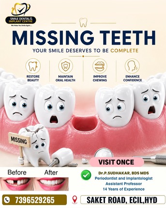 Hyderabad, Dental, Permanent Solutions For Missing Teeth &ndash; Advanced Dental Implants
