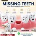 Permanent Solutions For Missing Teeth &ndash; Advanced Dental Implants