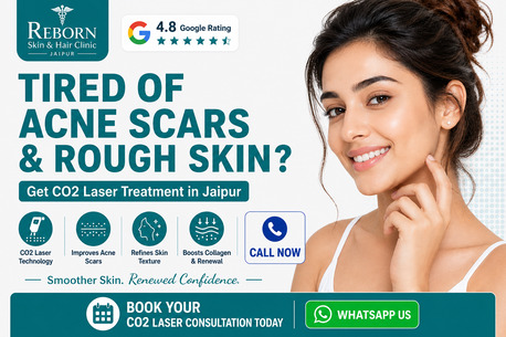 Jaipur, Health & Beauty Items, INR 7000,  Advanced CO2 Laser Treatment In Jaipur For Acne Scars