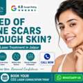 INR 7000,  Advanced CO2 Laser Treatment In Jaipur For Acne Scars