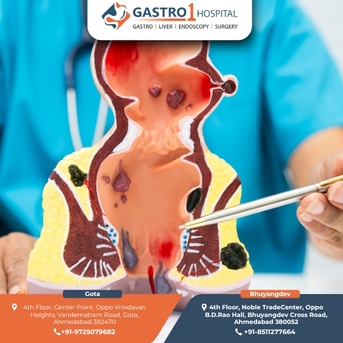 Ahmedabad, Health, Expert Fissure Doctor In Ahmedabad For Safe And Effective Treatment Solutions