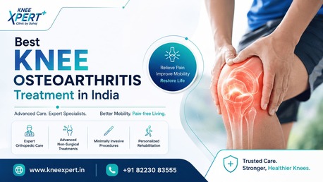 Indore, Health, Best Knee Osteoarthritis Treatment In India &ndash; KneeXpert