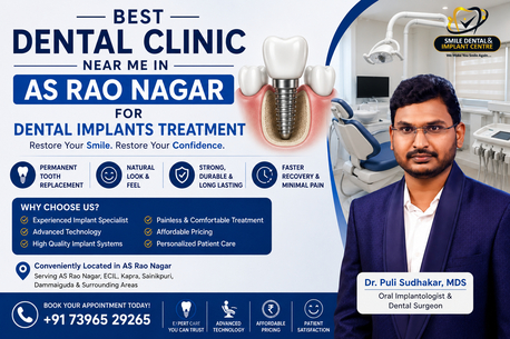 Hyderabad, Dental, Best Dental Clinic For Dental Implants Near AS Rao Nagar