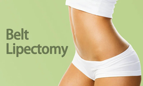 Mumbai, Health, Belt Lipectomy In Mumbai &ndash; 360° Body Contouring Surgery