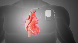 Abu Dhabi, Health, Expert Care At Pacemaker Clinic Abu Dhabi | Bone Care One Day Surgery Center